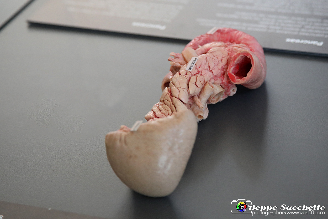 VBS_2730 - Pancreas - Mostra Body Worlds.jpg